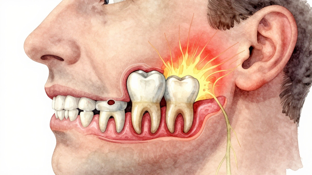 Křížový řez čelisti s postiženou osmičkou a šířením zánětu k uchu a čelu.